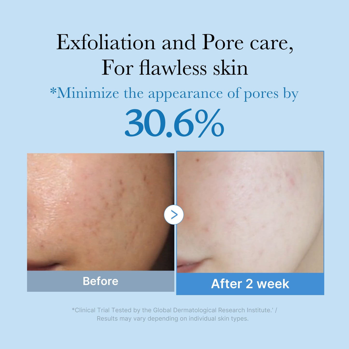 zero-pore-toner-o3 01_d6480b4e-3c08-4954-994a-ed5212c1839c.jpg