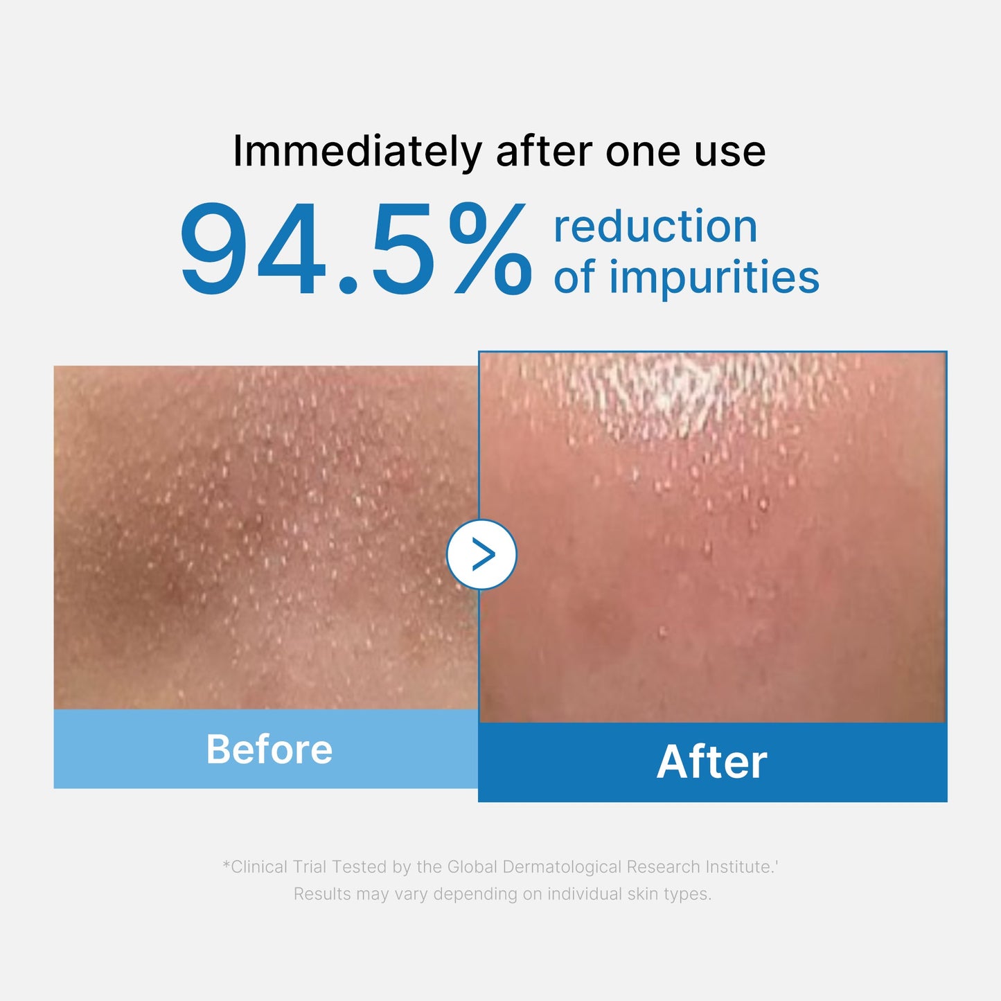 zero-pore-blackhead-deep-cleansing-oil-t7 01_eed557ec-5857-46a2-8b17-dbd67c692dcb.jpg