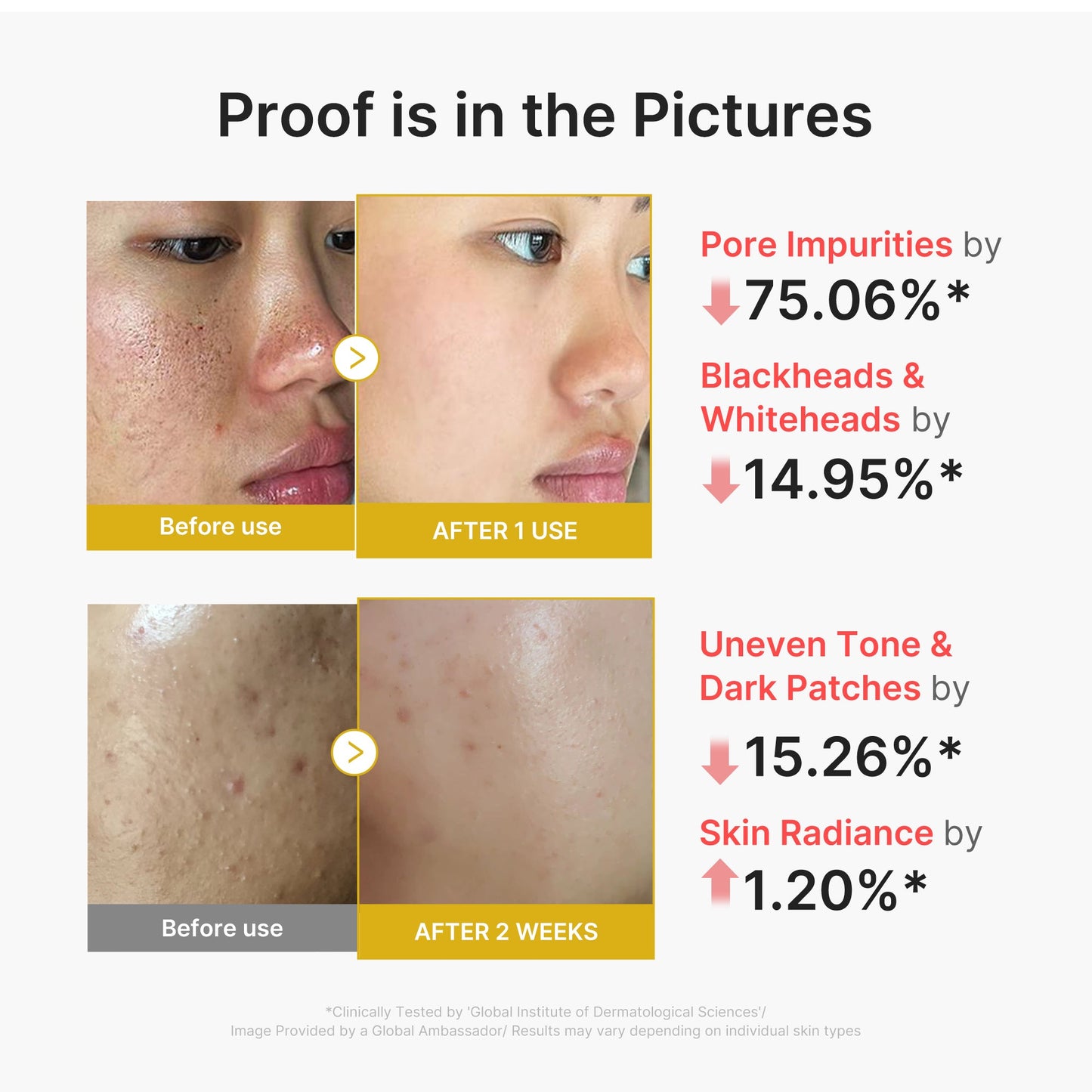 kojic-acid-turmeric-peel-shot-w4 02_45fe66d3-b3f6-4100-aa52-2afd7eded417.jpg