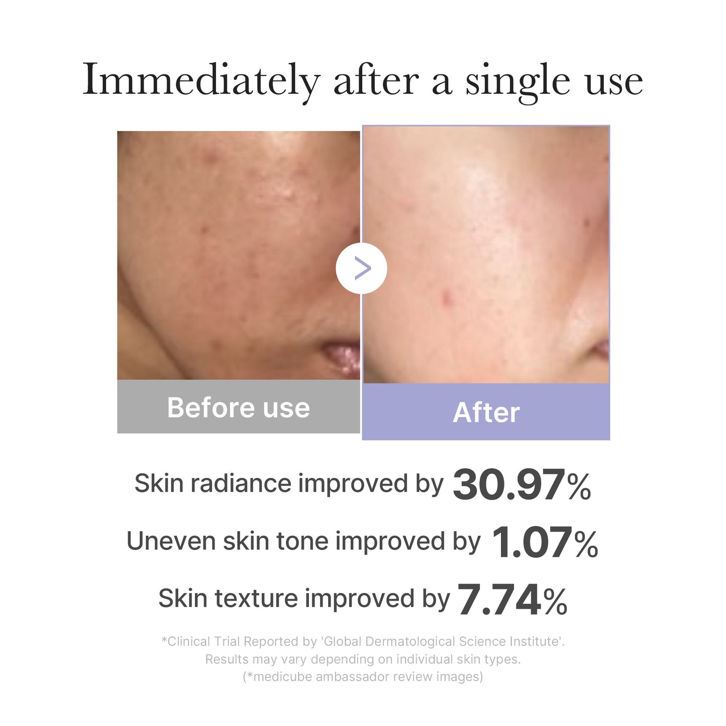 mini-booster-pro-u4 02_67c6dca5-a653-4442-8ff0-011e7aa64bcc.jpg