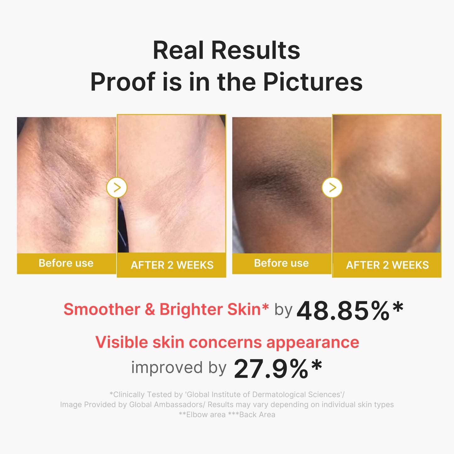 kojic-acid-turmeric-body-peel-shot-t2 02_72880cfc-382b-440b-8152-7e3dce87da2a.jpg
