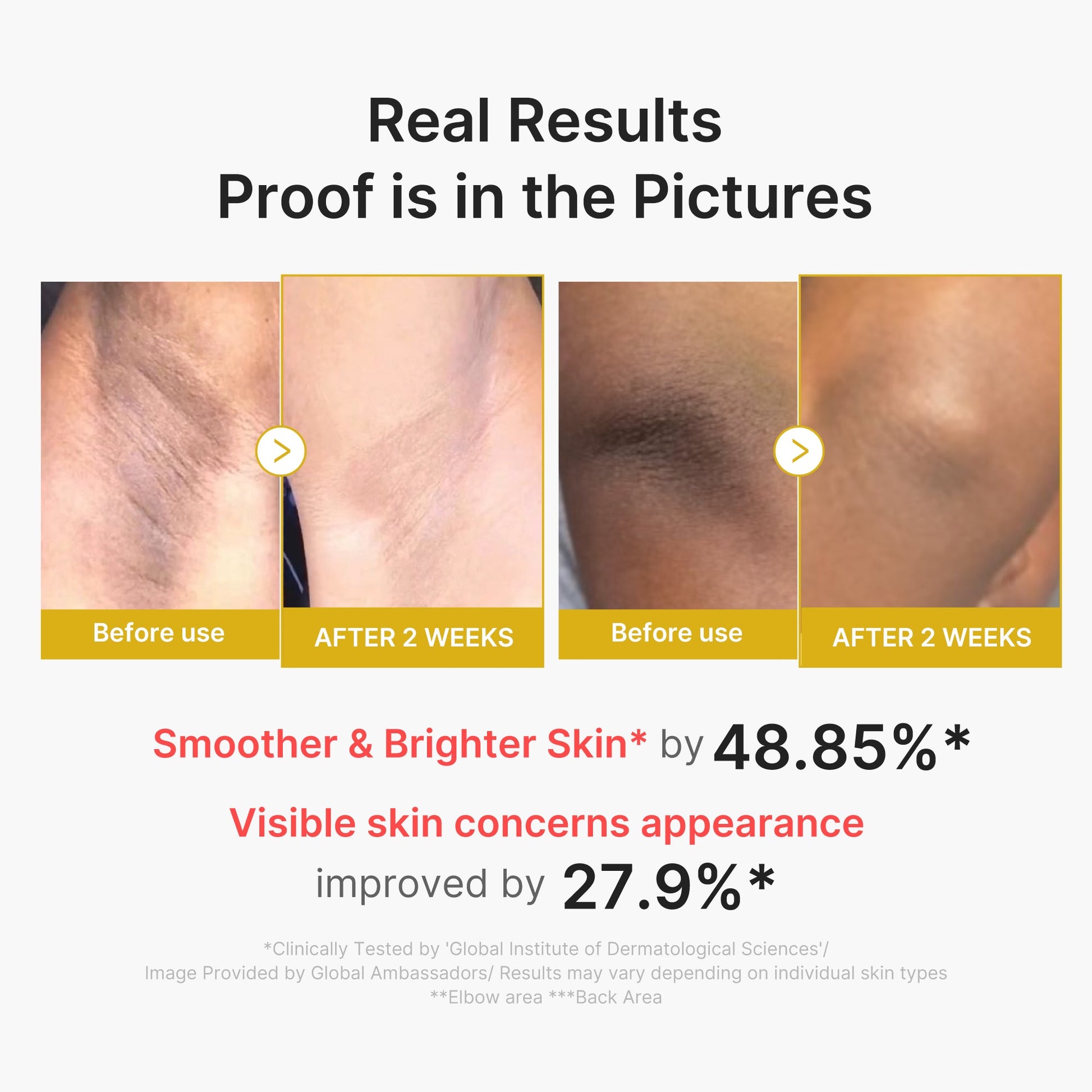 kojic-acid-turmeric-body-peel-shot-t2 02_72880cfc-382b-440b-8152-7e3dce87da2a.jpg