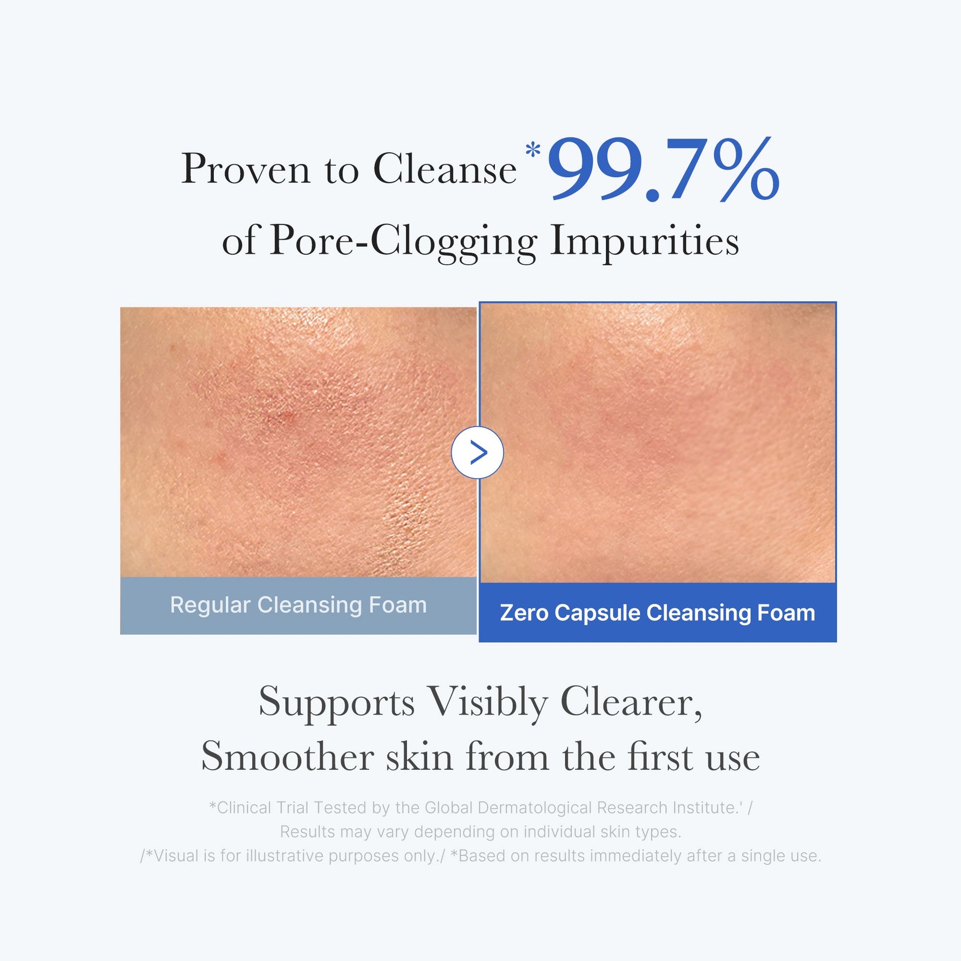 zero-pore-capsule-cleansing-foam-x6 02_c1fb9dfb-86c5-4038-8ff8-490d1006276c.jpg