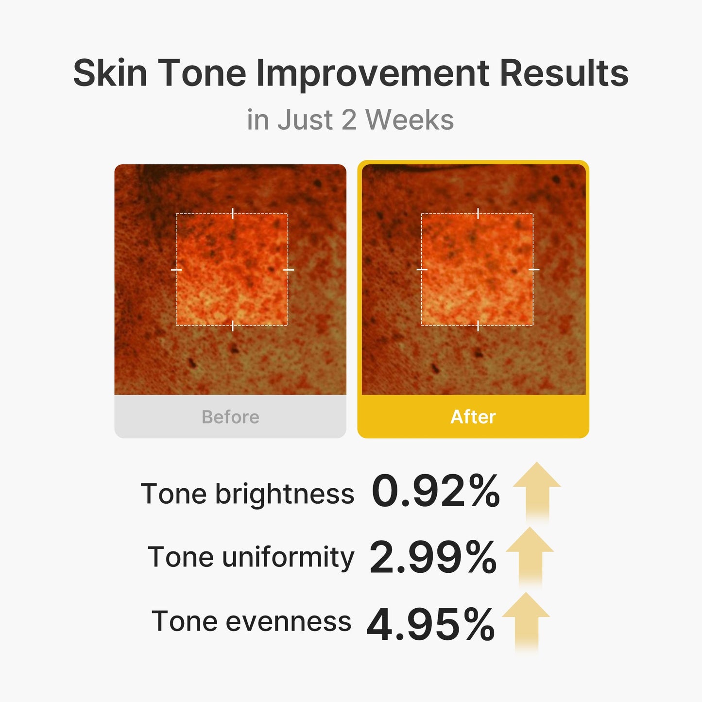 kojic-acid-turmeric-vita-capsule-cream-w5 03_2b626701-fc6c-4702-9e96-a2157a4f7f9d.jpg