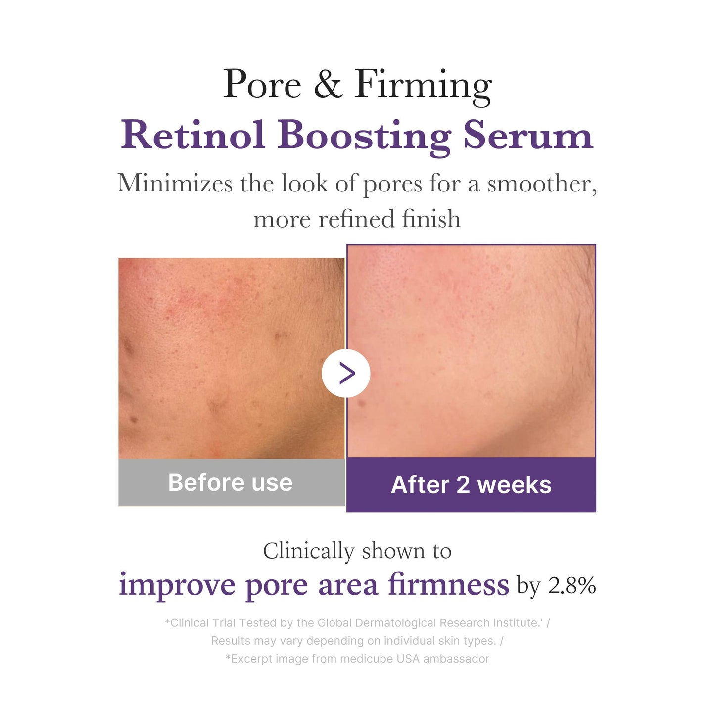 retinol-nmn-boosting-serum-r2 03_3510e7a5-5633-4a18-81ea-1389593bd517.jpg