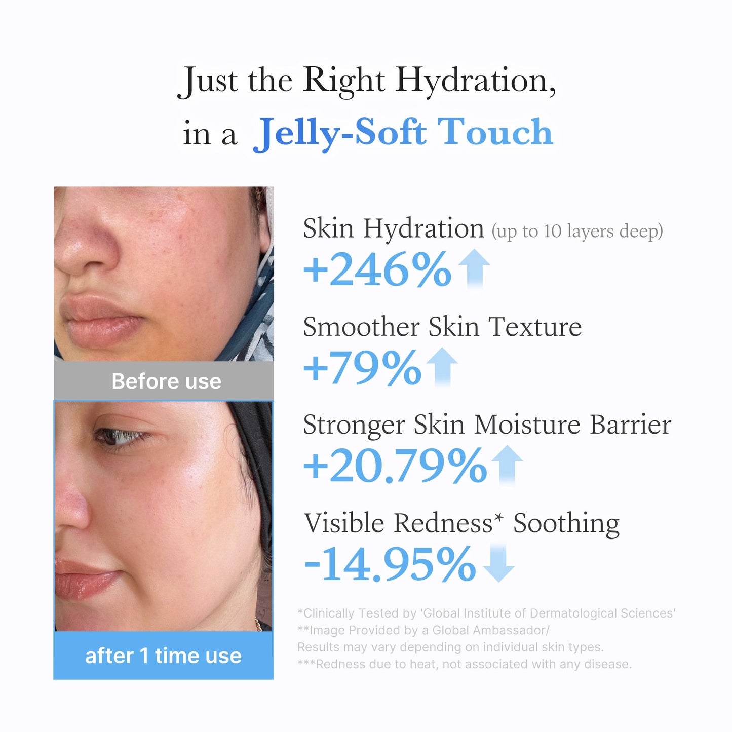 hyaluronic-ceramide-moisturizing-jelly-cream-m1 03_c39d66cc-0839-4e48-ab4a-d32143d06b1c.jpg