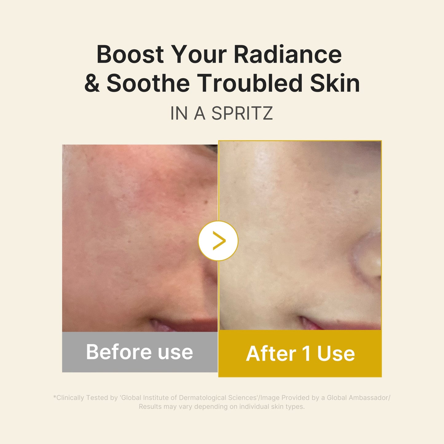 kojic-acid-turmeric-vitamin-gold-jelly-mist-serum-y8 03_dc9cd19e-4e57-49d3-9b66-c7762e8a63f1.jpg