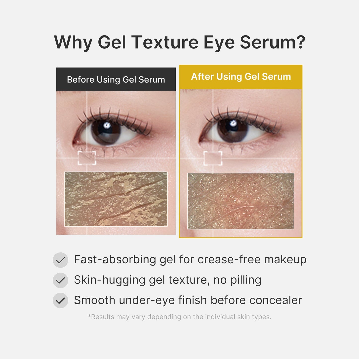 kojic-acid-tumeric-eye-gel-serum-t2 04_0487ef36-49f4-4294-8049-bb55118b05fe.jpg