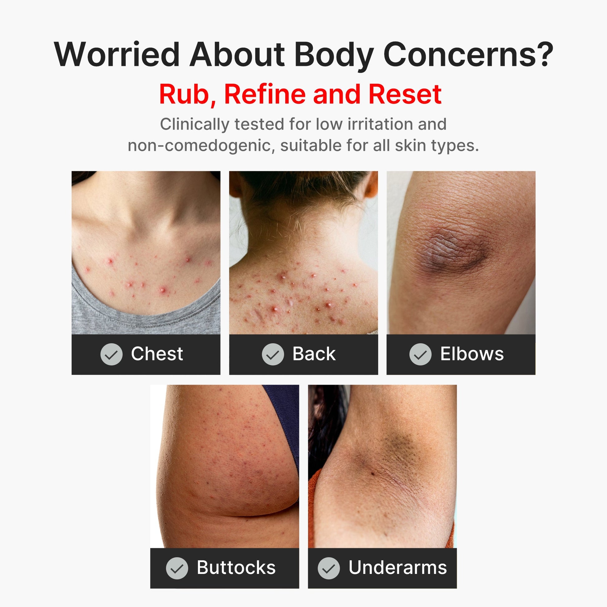 kojic-acid-turmeric-body-peel-shot-t2 04_8a7237f2-3ebf-401e-bd85-54841aeb3efc.jpg