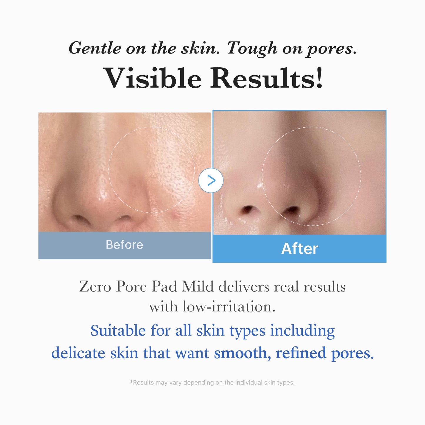 zero-pore-madecassoside-pads-mild-r7 04_6357f9f9-483b-4891-82c6-a58d336e62c8.jpg