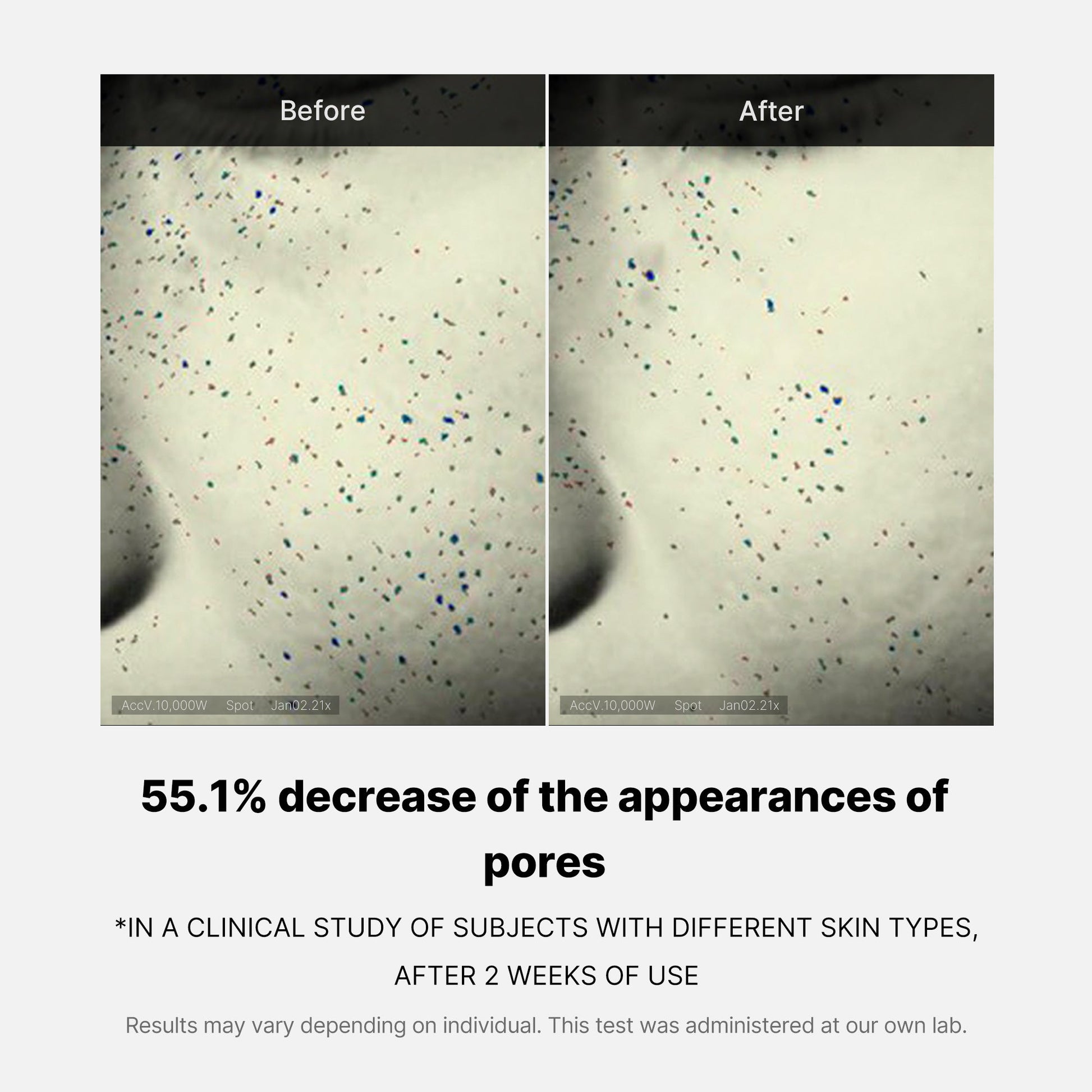 pore-care-duo-p9 05_12ddab8a-64be-4612-8ee1-27e5ec701921.jpg
