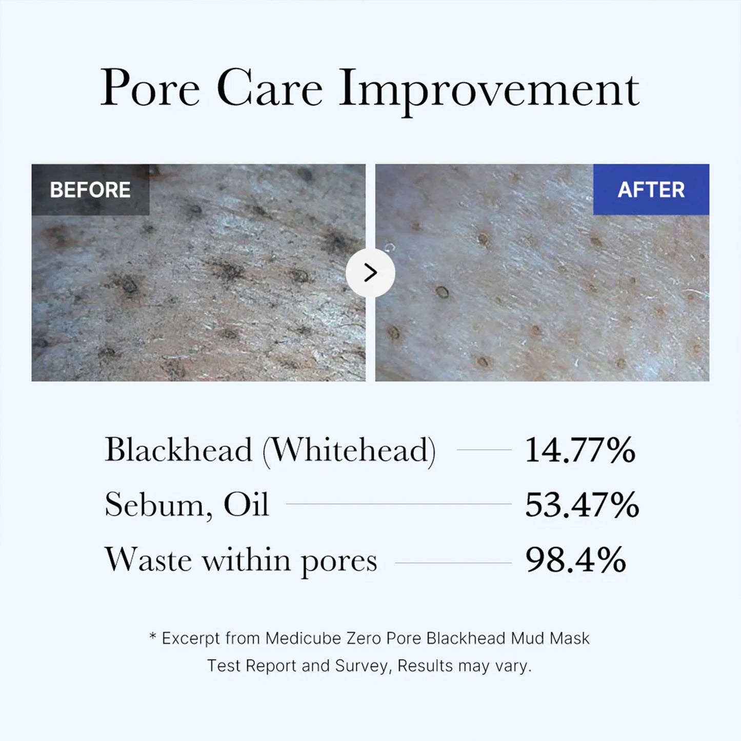 zero-pore-blackhead-mud-mask-d4 05_9362a158-c2b3-4525-acc0-631a2cfdea47.jpg