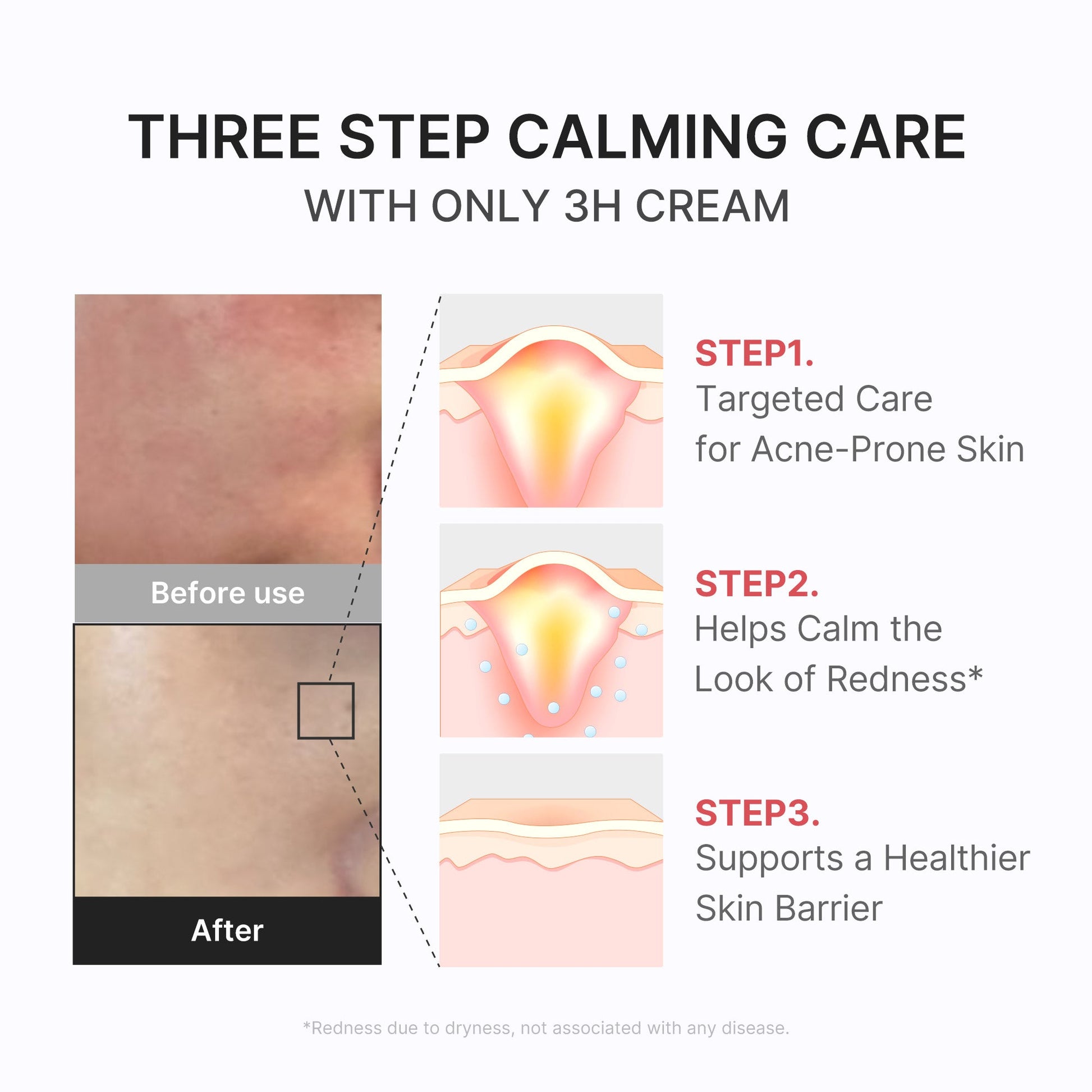 3h-daily-relief-cream-o2 3H_04.jpg