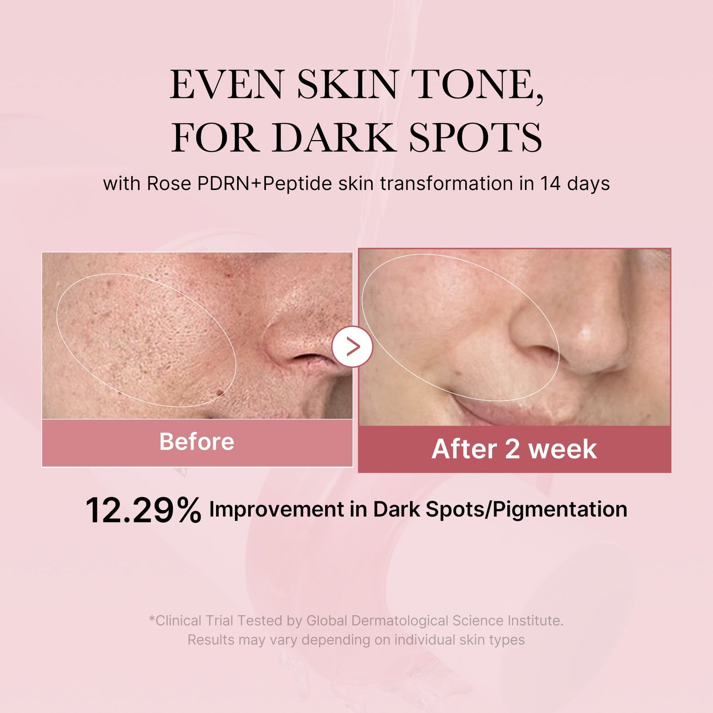 pdrn-pink-peptide-toner-o3 PDRN_01_308c518e-5ac6-4e54-99bd-eabc8796739b.jpg