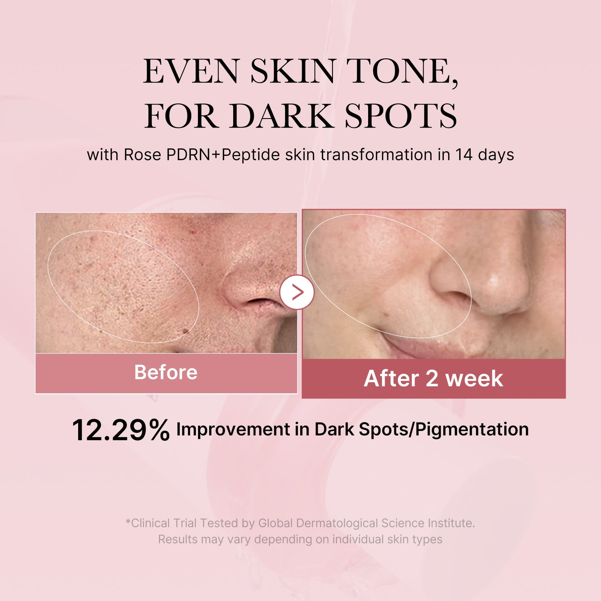 pdrn-pink-peptide-toner-o3 PDRN_01_308c518e-5ac6-4e54-99bd-eabc8796739b.jpg