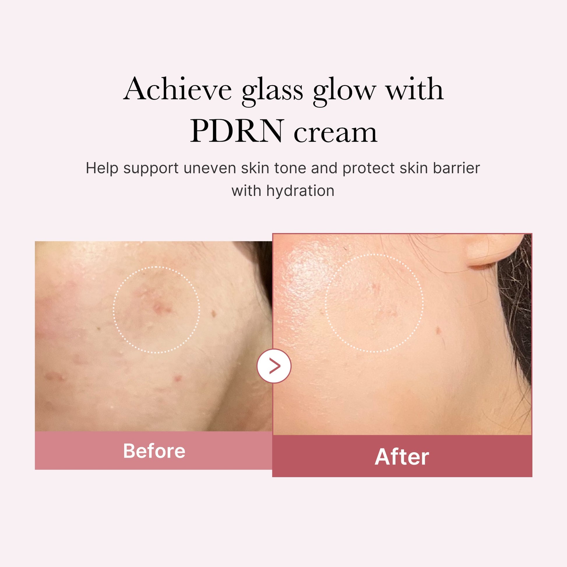 pdrn-pink-peptide-cream-b4 PDRN_02_d7805bfe-cf43-446a-b71b-a276683f136b.jpg