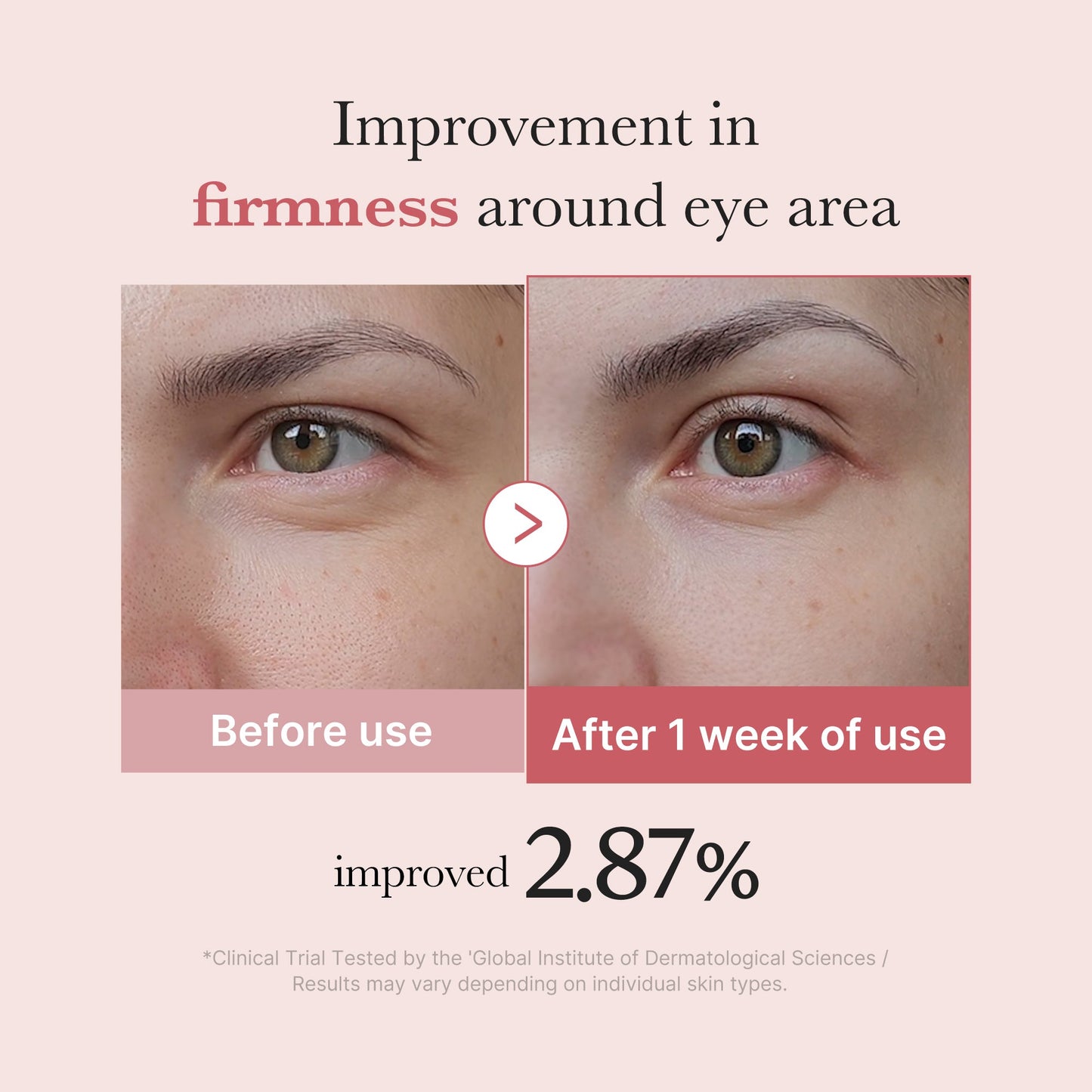 pdrn-pink-peptide-eye-cream-s7 PDRN_03_256dd753-0a2f-41b4-b3cd-bbfd3bc27018.jpg
