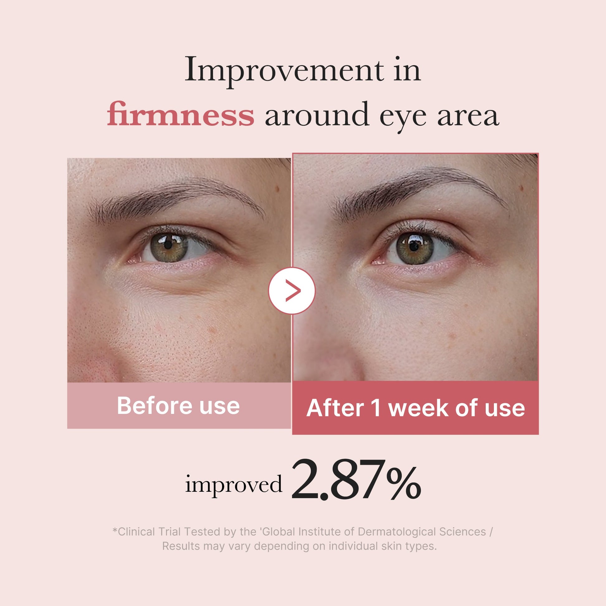 pdrn-pink-peptide-eye-cream-s7 PDRN_03_256dd753-0a2f-41b4-b3cd-bbfd3bc27018.jpg