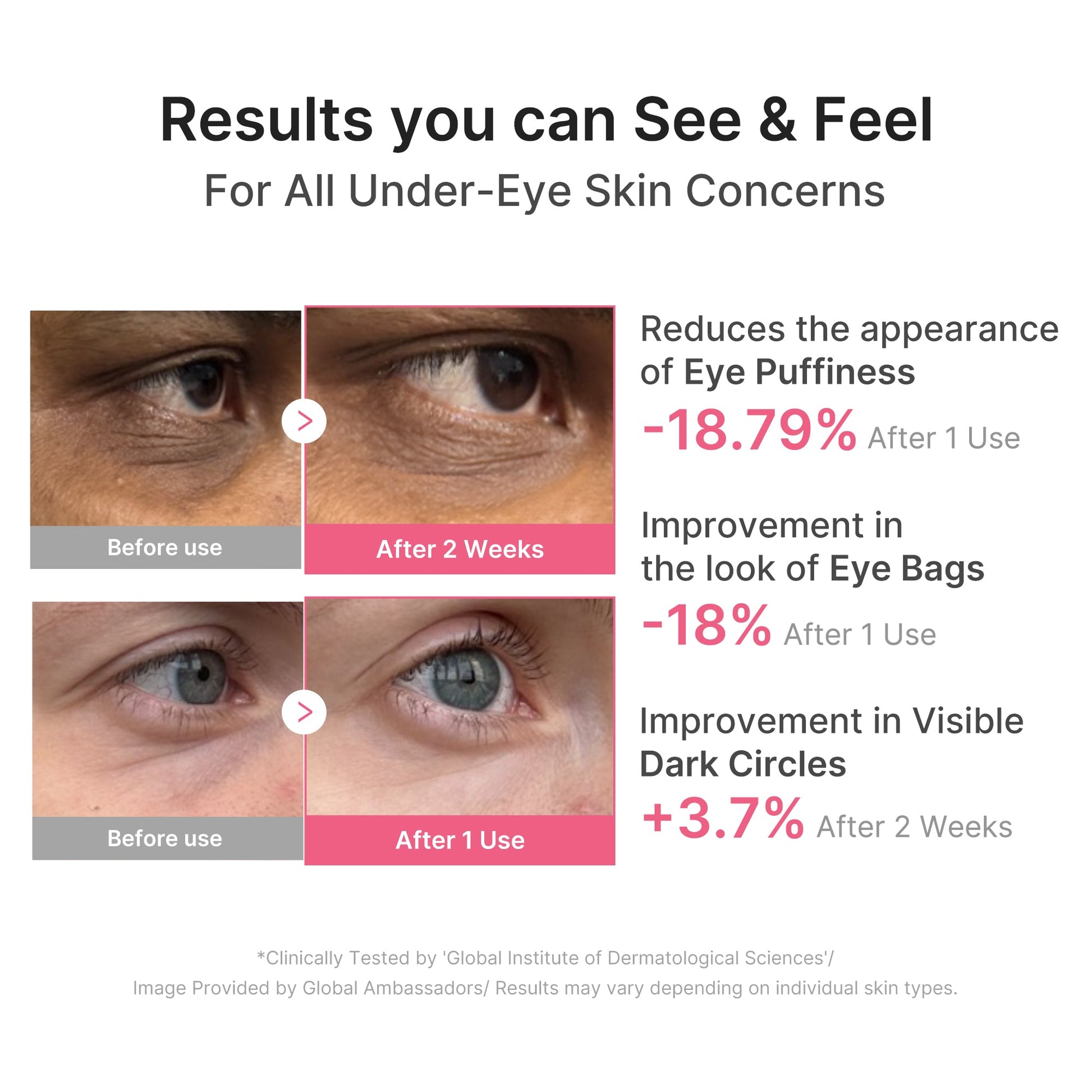 pdrn-caffeine-collagen-eye-patch-w3 PDRN_03_cdce2143-b8d8-43cb-ac69-fcbdf6640249.jpg