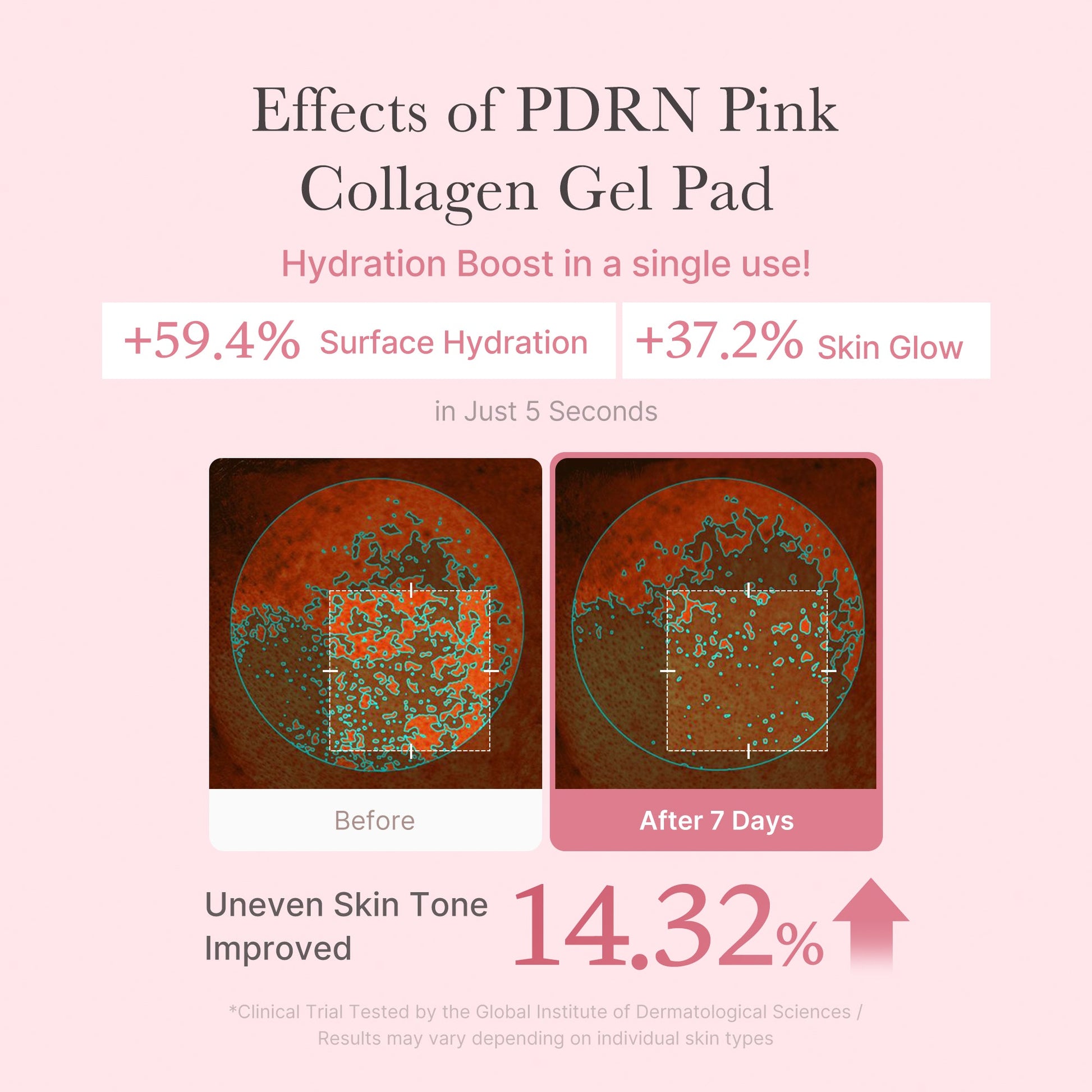 pdrn-pink-collagen-gel-toner-pad-z6 PDRN_04_f9a16a56-8d9e-4c47-a635-ed34ec3ed571.jpg