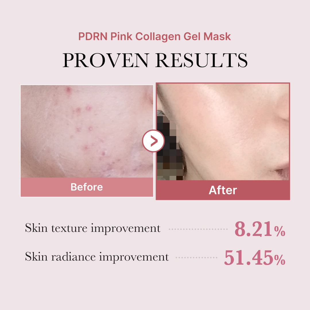 salmon-pdrn-pink-collagen-jelly-gel-mask-g5 PDRN_12.jpg