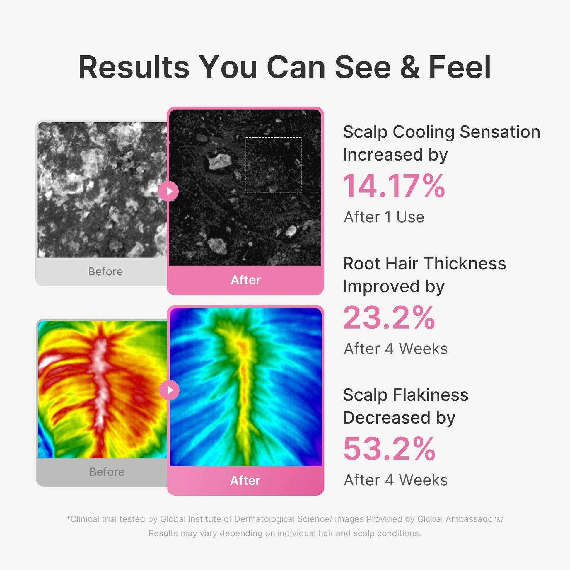 rosemary-pdrn-scalp-serum-q3 US_ME_RosemaryAmpoule_th04.jpg