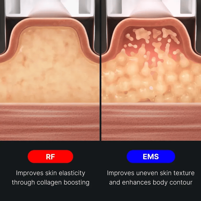 age-r-contour-body-shot-r6 img.webp